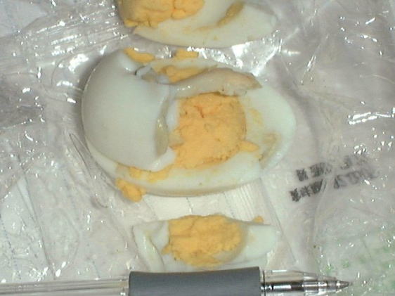 異常卵の例